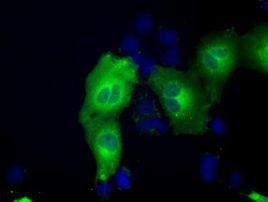 ACAT2 Antibody in Immunocytochemistry (ICC/IF)