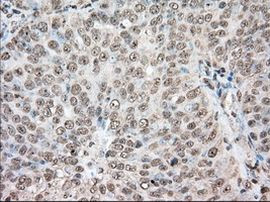 ACAT2 Antibody in Immunohistochemistry (Paraffin) (IHC (P))