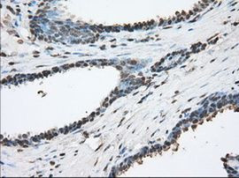 ACAT2 Antibody in Immunohistochemistry (Paraffin) (IHC (P))