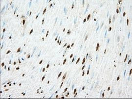 ACAT2 Antibody in Immunohistochemistry (Paraffin) (IHC (P))