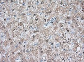 ACAT2 Antibody in Immunohistochemistry (Paraffin) (IHC (P))