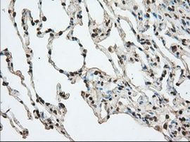 ACAT2 Antibody in Immunohistochemistry (Paraffin) (IHC (P))