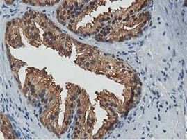 ACAT2 Antibody in Immunohistochemistry (Paraffin) (IHC (P))