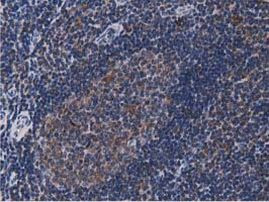 ACAT2 Antibody in Immunohistochemistry (Paraffin) (IHC (P))