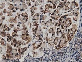 ACAT2 Antibody in Immunohistochemistry (Paraffin) (IHC (P))