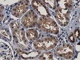 ACAT2 Antibody in Immunohistochemistry (Paraffin) (IHC (P))