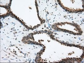 ACAT2 Antibody in Immunohistochemistry (Paraffin) (IHC (P))