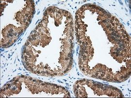 ACAT2 Antibody in Immunohistochemistry (Paraffin) (IHC (P))