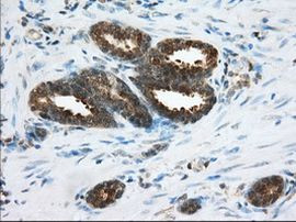 ACAT2 Antibody in Immunohistochemistry (Paraffin) (IHC (P))