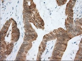 ACAT2 Antibody in Immunohistochemistry (Paraffin) (IHC (P))