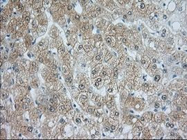 ACAT2 Antibody in Immunohistochemistry (Paraffin) (IHC (P))