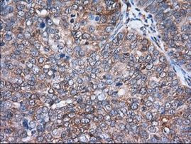 ACAT2 Antibody in Immunohistochemistry (Paraffin) (IHC (P))