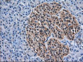 ACAT2 Antibody in Immunohistochemistry (Paraffin) (IHC (P))