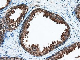 ACAT2 Antibody in Immunohistochemistry (Paraffin) (IHC (P))