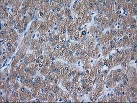 ACAT2 Antibody in Immunohistochemistry (Paraffin) (IHC (P))