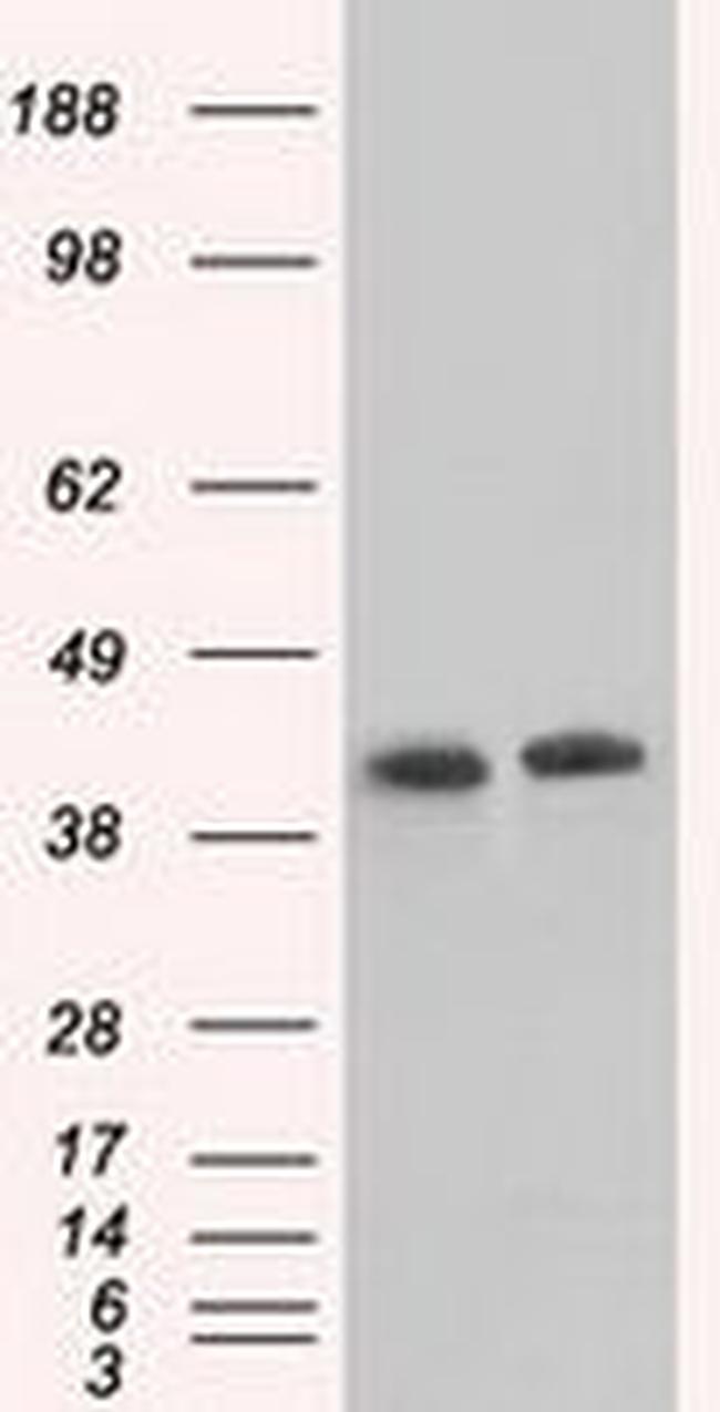 ACAT2 Antibody in Western Blot (WB)