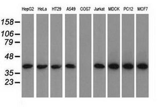 ACAT2 Antibody in Western Blot (WB)