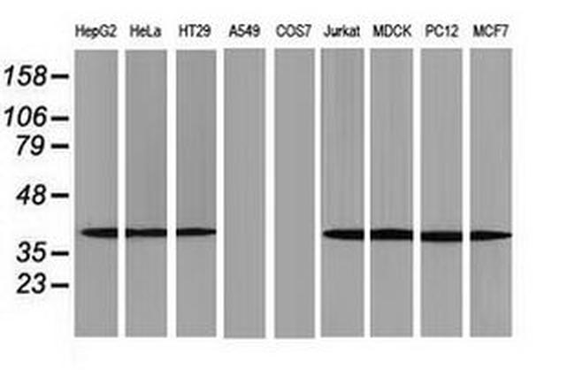 ACAT2 Antibody in Western Blot (WB)