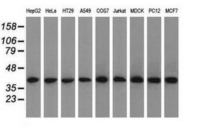 ACAT2 Antibody in Western Blot (WB)