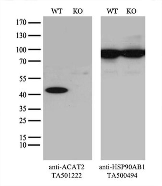 ACAT2 Antibody in Western Blot (WB)