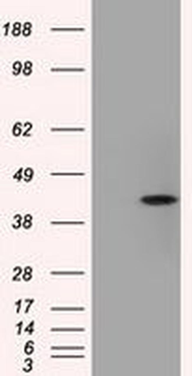 ACAT2 Antibody in Western Blot (WB)