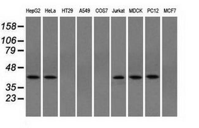 ACAT2 Antibody in Western Blot (WB)