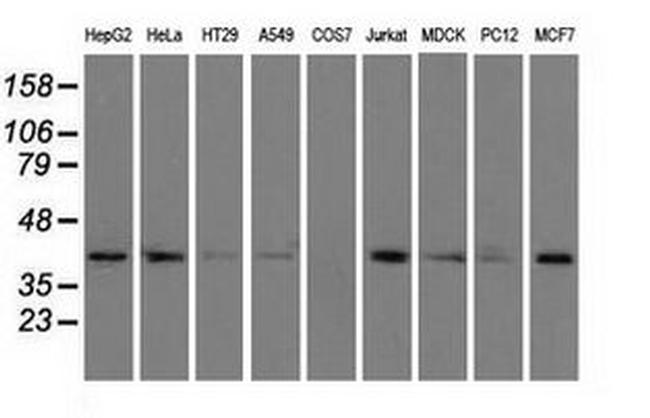 ACAT2 Antibody in Western Blot (WB)