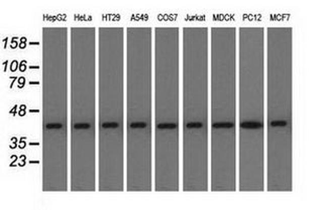 ACAT2 Antibody in Western Blot (WB)