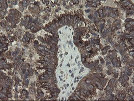 ACBD3 Antibody in Immunohistochemistry (Paraffin) (IHC (P))