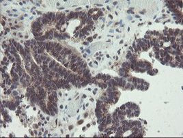 ACBD3 Antibody in Immunohistochemistry (Paraffin) (IHC (P))