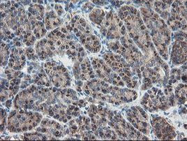 ACBD3 Antibody in Immunohistochemistry (Paraffin) (IHC (P))