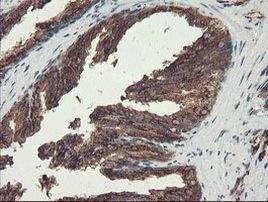 ACBD3 Antibody in Immunohistochemistry (Paraffin) (IHC (P))