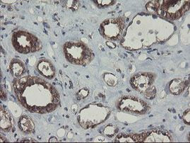 ACBD3 Antibody in Immunohistochemistry (Paraffin) (IHC (P))