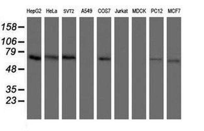 ACBD3 Antibody in Western Blot (WB)