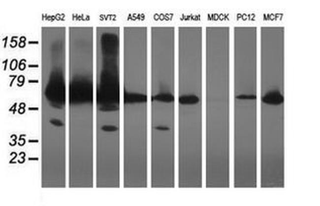 ACBD3 Antibody in Western Blot (WB)