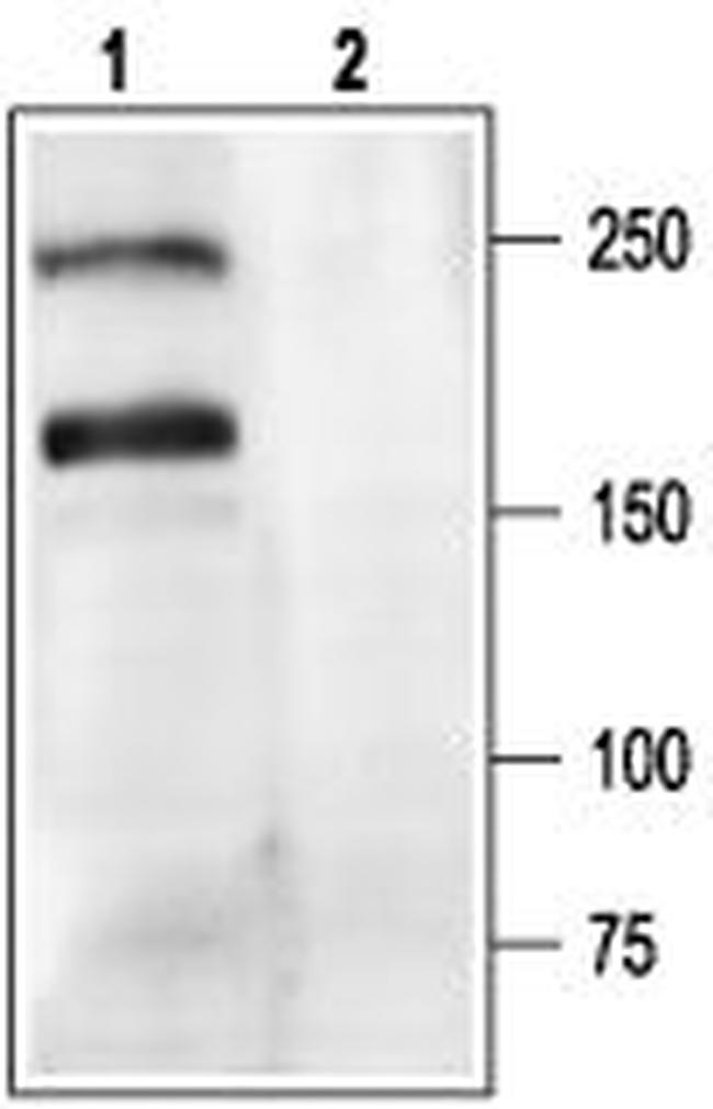 CACNA1A (CaV2.1) Antibody in Western Blot (WB)