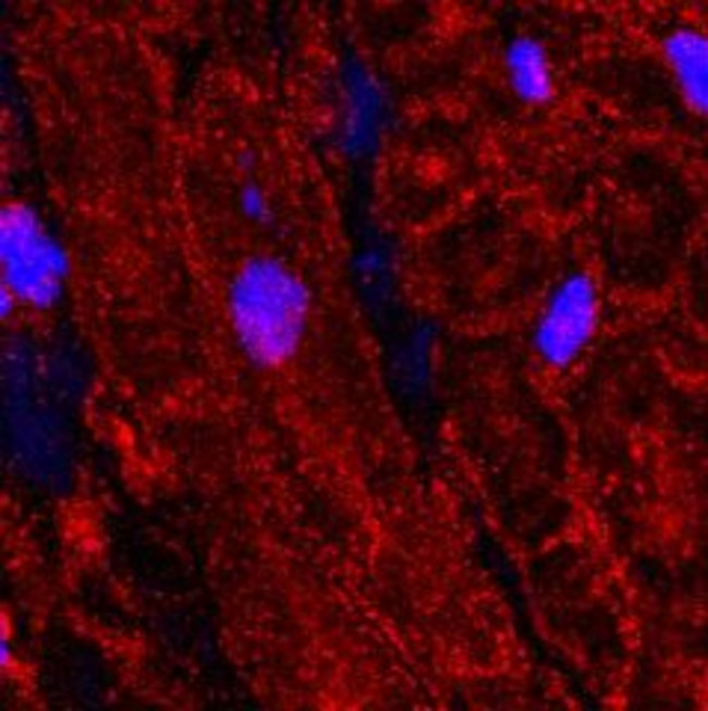 CaV1.2 (CACNA1C) Antibody in Immunohistochemistry (Paraffin) (IHC (P))