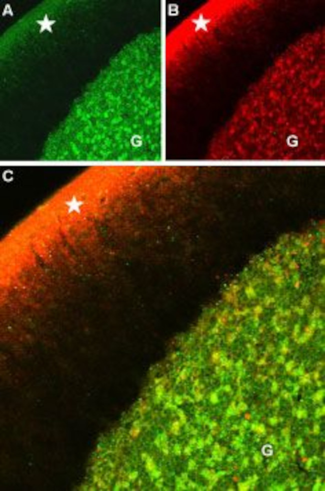 CaV1.2 (CACNA1C) Antibody in Immunohistochemistry (Paraffin) (IHC (P))