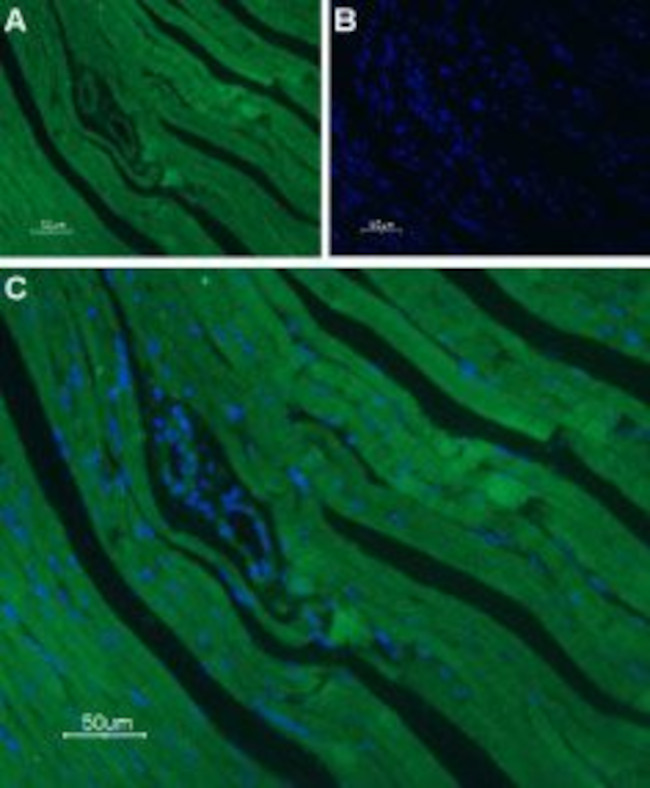 CaV1.2 (CACNA1C) Antibody in Immunohistochemistry (Paraffin) (IHC (P))