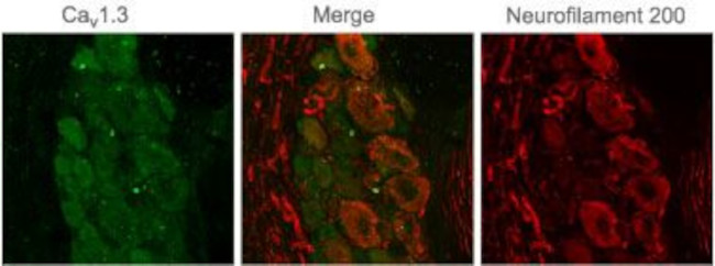 CaV1.3 (CACNA1D) Antibody in Immunohistochemistry (IHC)