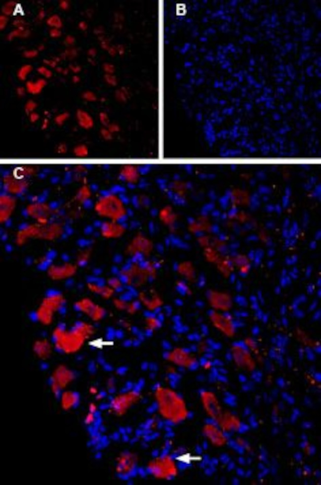 CaV1.3 (CACNA1D) Antibody in Immunohistochemistry (IHC)