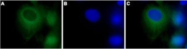 TRPC3 Antibody in Immunocytochemistry (ICC/IF)