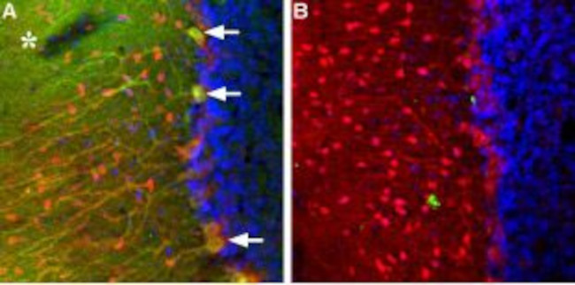 TRPC3 Antibody in Immunohistochemistry (Paraffin) (IHC (P))