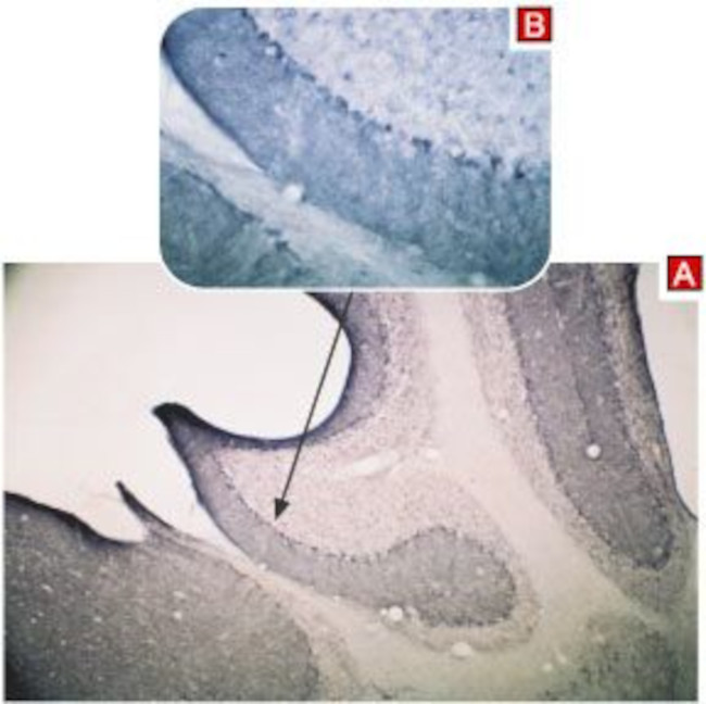 TRPC3 Antibody in Immunohistochemistry (Paraffin) (IHC (P))