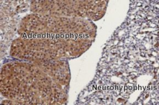 TRPC3 Antibody in Immunohistochemistry (Paraffin) (IHC (P))