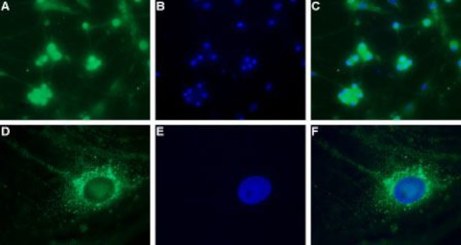 CaV3.2 (CACNA1H) Antibody in Immunocytochemistry (ICC/IF)