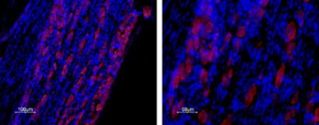 CaV3.2 (CACNA1H) Antibody in Immunohistochemistry (Frozen) (IHC (F))