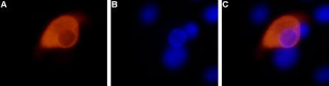 TRPV1 (VR1) Antibody in Immunocytochemistry (ICC/IF)