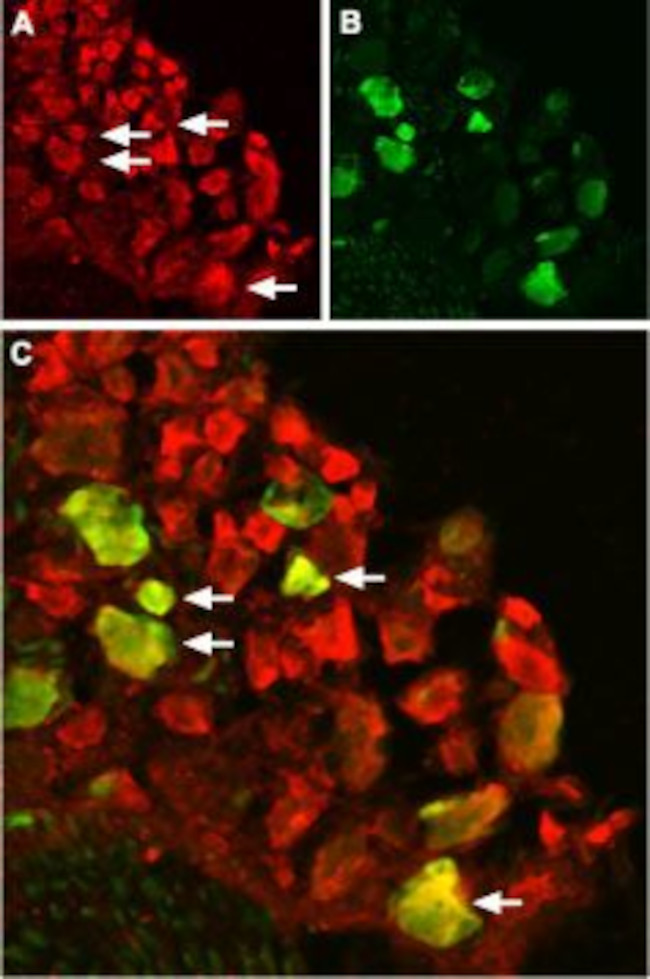 TRPV1 (VR1) Antibody in Immunohistochemistry (IHC)