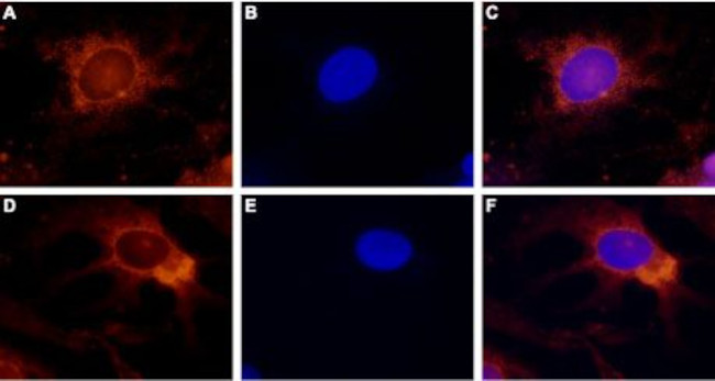 TRPV4 Antibody in Immunocytochemistry (ICC/IF)